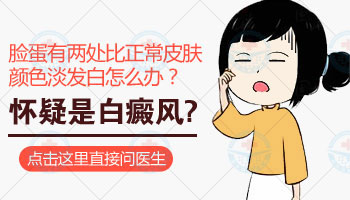 如何治疗儿童白癜风效果好呢?