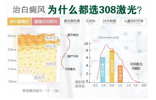 做一次308激光多少钱呢