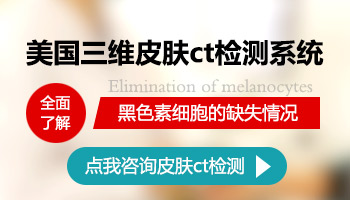  白斑在伍德灯下显示阴性代表什么 