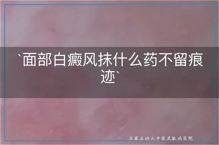 `面部白癜风抹什么药不留痕迹`