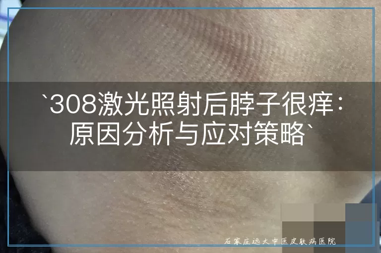 `308激光照射后脖子很痒：原因分析与应对策略`