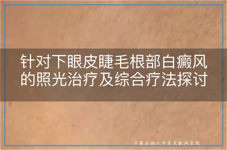 针对下眼皮睫毛根部白癜风的照光治疗及综合疗法探讨