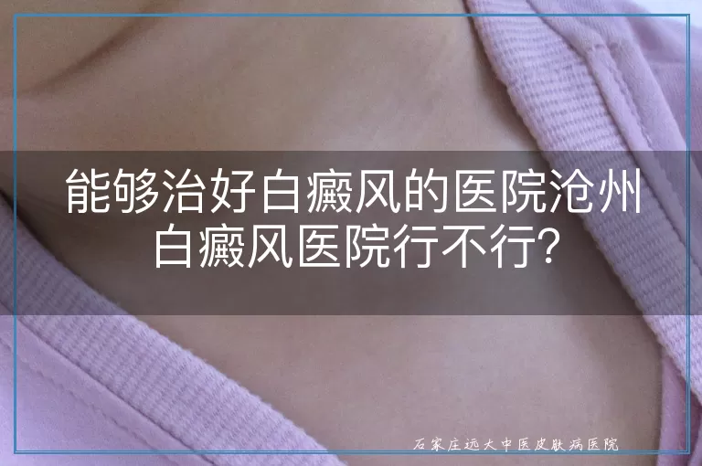 能够治好白癜风的医院沧州白癜风医院行不行？