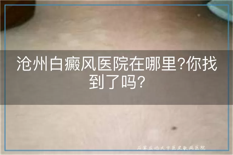 沧州白癜风医院在哪里?你找到了吗?