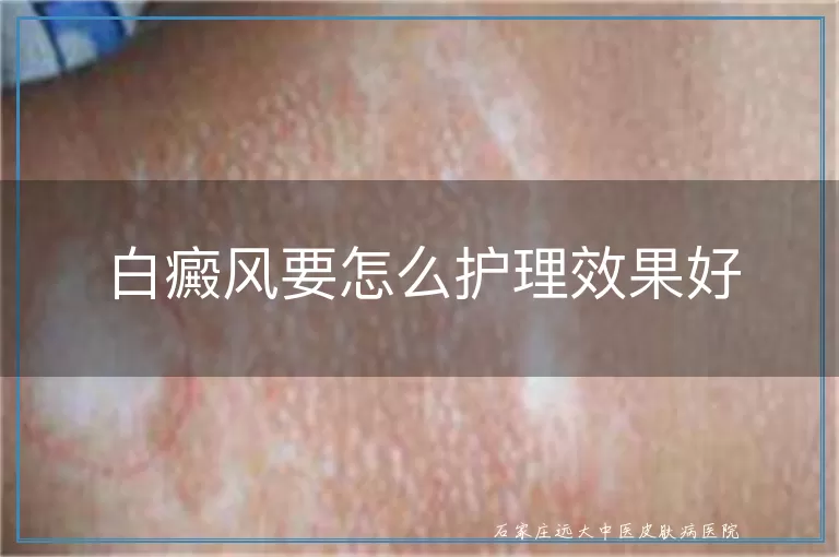 白癜风要怎么护理效果好