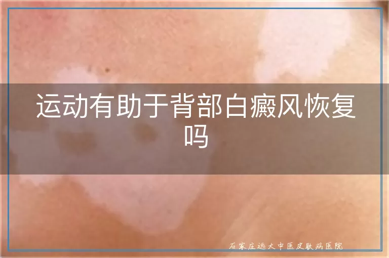 运动有助于背部白癜风恢复吗