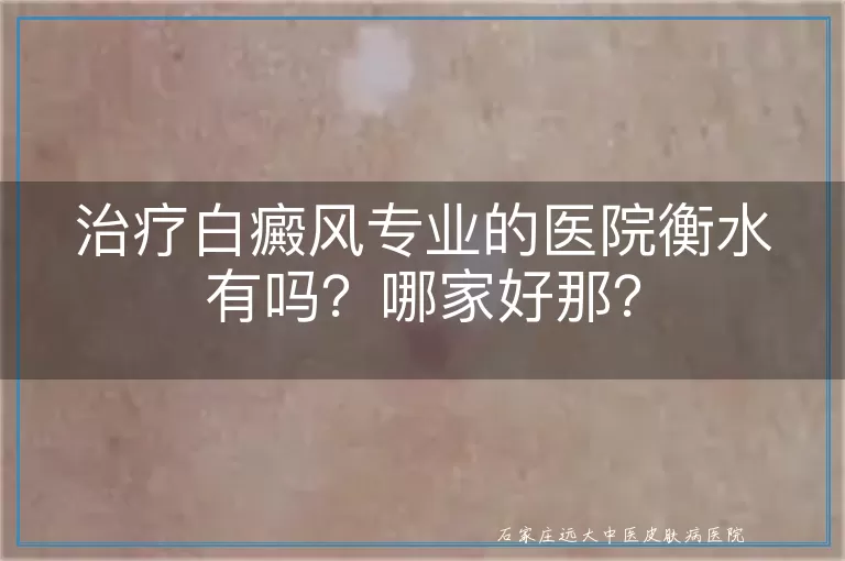 治疗白癜风专业的医院衡水有吗？哪家好那？