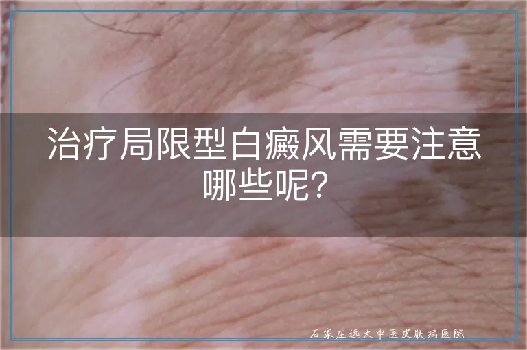 治疗局限型白癜风需要注意哪些呢？