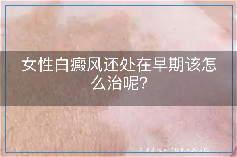 女性白癜风还处在早期该怎么治呢？