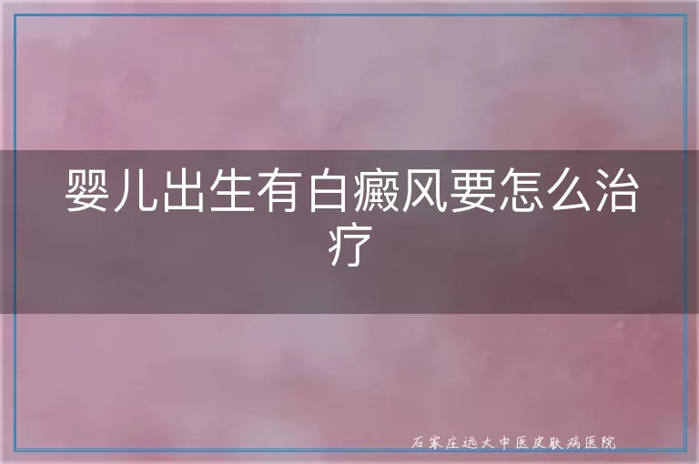 婴儿出生有白癜风要怎么治疗