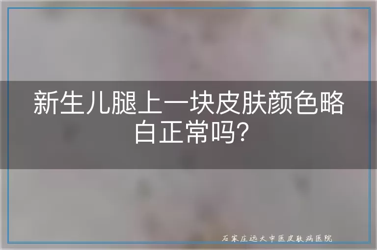 新生儿腿上一块皮肤颜色略白正常吗？