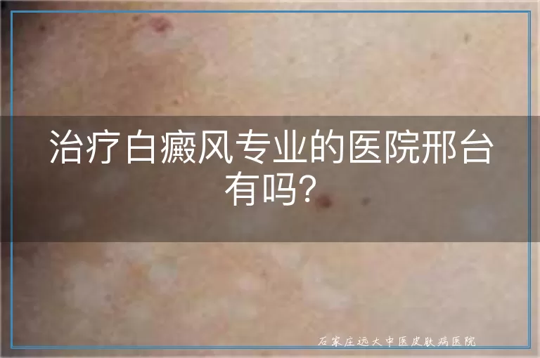 治疗白癜风专业的医院邢台有吗？