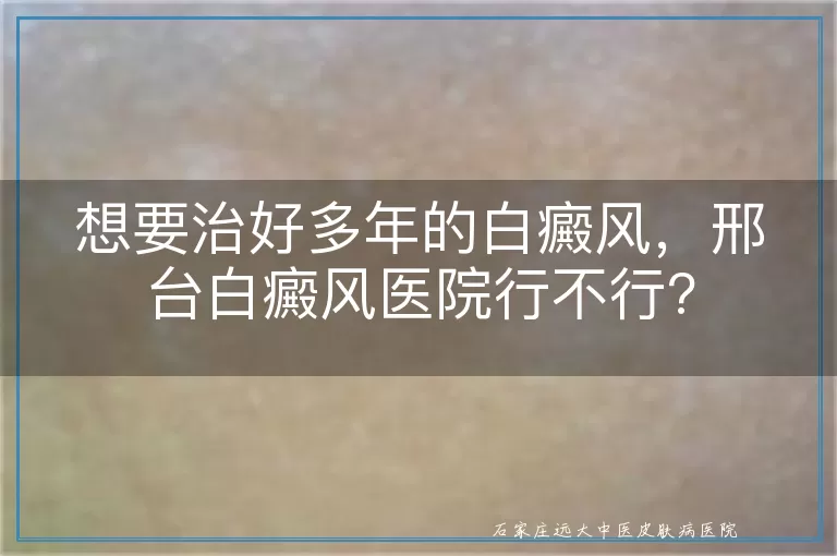 想要治好多年的白癜风，邢台白癜风医院行不行?