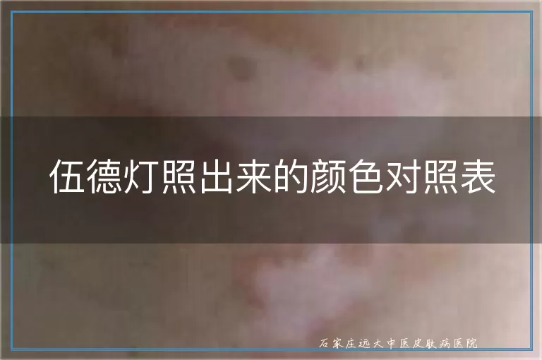 伍德灯照出来的颜色对照表