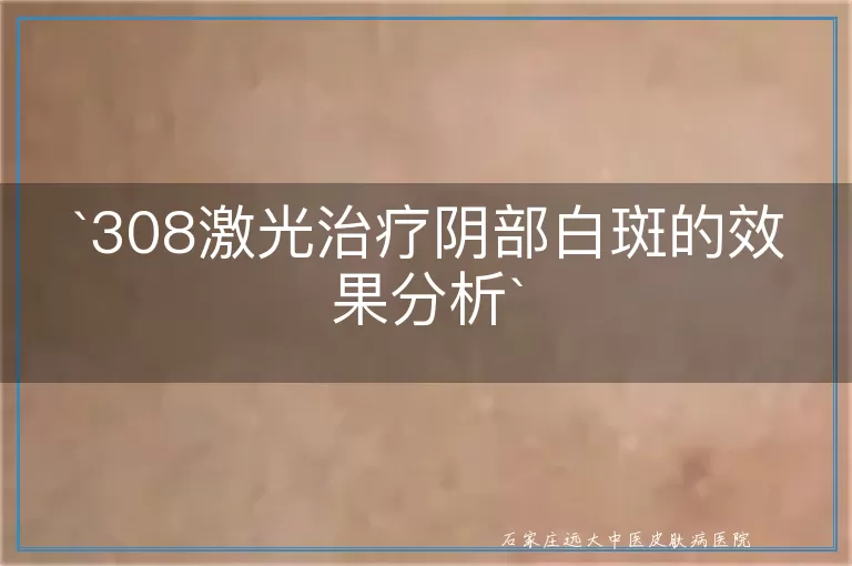 `308激光治疗阴部白斑的效果分析`