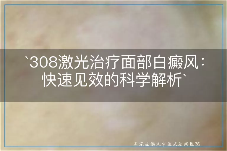 `308激光治疗面部白癜风：快速见效的科学解析`