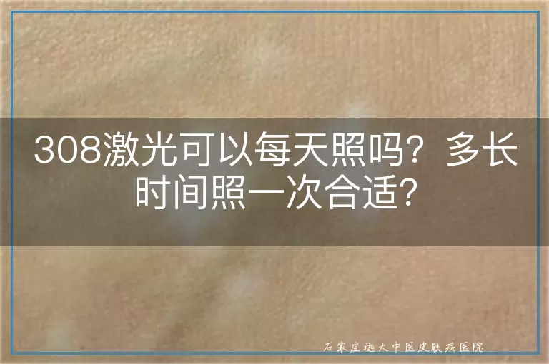 308激光可以每天照吗？多长时间照一次合适？